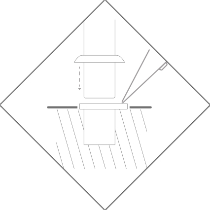 Removable <br> anchor